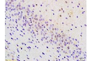 Formalin-fixed and paraffin embedded mouse brain tissue labeled with Anti-BRN3A Polyclonal Antibody, Unconjugated at 1:200 followed by conjugation to the secondary antibody, (SP-0023), and DAB staining