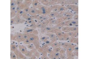 IHC-P analysis of Kidney tissue, with DAB staining. (CES1 antibody  (AA 18-299))