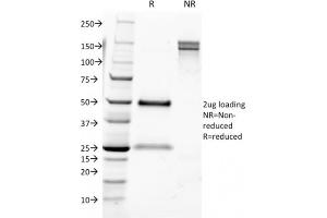 SDS-PAGE Analysis Purified CD9 Mouse Monoclonal Antibody (CD9/1631). (CD9 antibody)