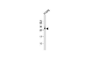 Anti-ELOVL6 Antibody (N-term) at 1:1000 dilution + human lung lysate Lysates/proteins at 20 μg per lane.