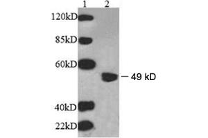Western Blotting (WB) image for anti-UDP-Gal:betaGlcNAc beta 1,3-Galactosyltransferase, Polypeptide 2 (B3GALT2) antibody (ABIN244874)