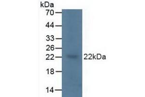 Detection of KRAS in Porcine Brain Tissue using Polyclonal Antibody to V-Ki-Ras2 Kirsten Rat Sarcoma Viral Oncogene Homolog (KRAS) (K-RAS antibody  (AA 1-189))