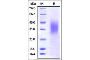 SDS-PAGE (SDS) image for B and T Lymphocyte Associated (BTLA) (AA 30-176) (Active) protein (His tag) (ABIN4949159)