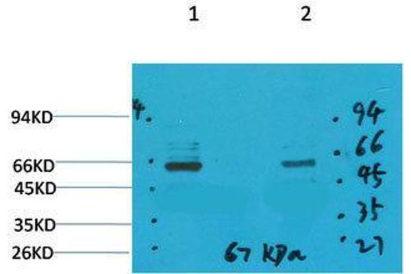 SLC6A1 antibody