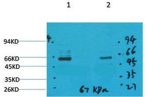 Western Blot (WB) analysis of 1) Mouse Brain Tissue, 2)Rat Brain Tissue with GABA Transporter 1 Rabbit Polyclonal Antibody diluted at 1:2000.
