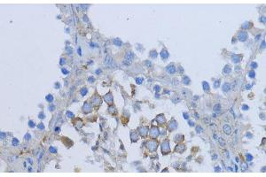 Immunohistochemistry of paraffin-embedded Mouse testis using NRG4 Polyclonal Antibody at dilution of 1:200 (40x lens). (Neuregulin 4 antibody)