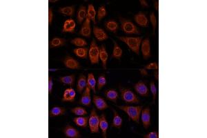 Immunofluorescence analysis of L929 cells using TMEM11 antibody (ABIN7270952) at dilution of 1:100. (TMEM11 antibody  (AA 1-80))