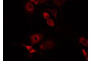 ABIN6275993 staining Hela by IF/ICC. (FZD8 antibody  (N-Term))