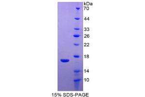 SDS-PAGE (SDS) image for WAP Four-Disulfide Core Domain 5 (WFDC5) (AA 1-123) protein (His tag) (ABIN1981162)