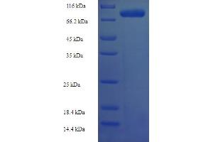 SDS-PAGE (SDS) image for Ribonucleoprotein, PTB-Binding 2 (RAVER2) (AA 2-691) protein (His-SUMO Tag) (ABIN5711835) (RAVER2 Protein (AA 2-691) (His-SUMO Tag))