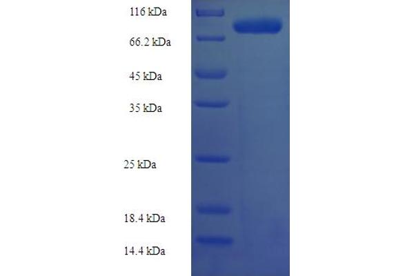 RAVER2 Protein (AA 2-691) (His-SUMO Tag)