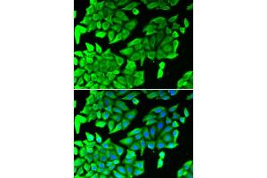 Immunofluorescence analysis of U2OS cells using MAPK8 antibody (ABIN1873632). (JNK antibody)
