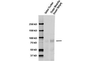 Western blot analysis of Rat kidney tissue lysates showing detection of ENaC protein using Rabbit Anti-ENaC Polyclonal Antibody . (SCNN1A antibody  (AA 46-68) (Biotin))