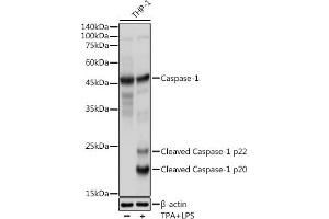 Immunohistochemistry of paraffin-embedded human colon using Caspase-1 Rabbit pAb (ABIN3021170, ABIN3021171, ABIN3021172 and ABIN6214049) at dilution of 1:100 (40x lens).