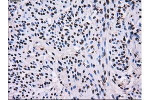 Image no. 2 for anti-L1 Cell Adhesion Molecule (L1CAM) antibody (ABIN1499084) (L1CAM antibody)