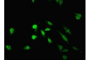 Immunofluorescent analysis of Hela cells using ABIN7172224 at dilution of 1:100 and Alexa Fluor 488-congugated AffiniPure Goat Anti-Rabbit IgG(H+L) (TM2D3 antibody  (AA 31-153))