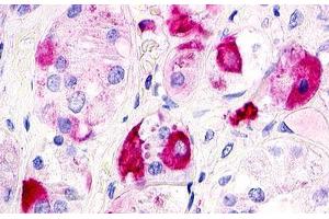 Image no. 1 for anti-G Protein-Coupled Receptor 12 (GPR12) (Extracellular Domain) antibody (ABIN1048701) (G Protein-Coupled Receptor 12 antibody  (Extracellular Domain))