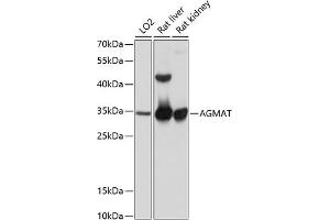 Western blot analysis of extracts of various cell lines, using AGMAT antibody (ABIN6131218, ABIN6136634, ABIN6136635 and ABIN6215786) at 1:1000 dilution. (AGMAT antibody  (AA 1-352))