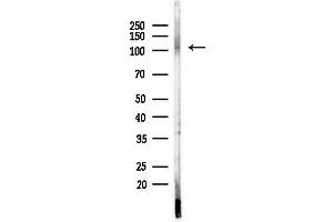 anti-Non-SMC Condensin I Complex, Subunit G (NCAPG) (C-Term) antibody