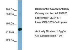 WB Suggested Anti-HOXD12  Antibody Titration: 0. (HOXD12 antibody  (Middle Region))