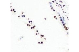 Immunohistochemical analysis of CGBP staining in mouse lung formalin fixed paraffin embedded tissue section. (CXXC1 antibody)