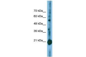 Host: Rabbit Target Name: CBFB Sample Type: Jurkat Whole Cell lysates Antibody Dilution: 1. (CBFB antibody  (N-Term))