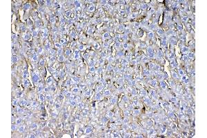 IHC analysis of CD105 using anti-CD105 antibody . (Endoglin antibody  (AA 27-226))