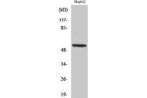Western Blotting (WB) image for anti-Cytochrome P450, Family 26, Subfamily A, Polypeptide 1 (CYP26A1) (Internal Region) antibody (ABIN3184168) (CYP26A1 antibody  (Internal Region))
