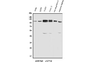 Western blot analysis of USP16 using anti-USP16 antibody (ABIN7602640). (USP16 antibody  (AA 9-823))