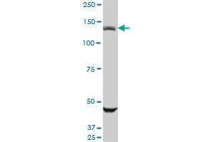 USP45 monoclonal antibody (M01), clone 1H2. (USP45 antibody  (AA 106-196))