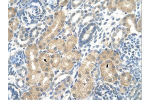 KHK antibody was used for immunohistochemistry at a concentration of 4-8 ug/ml. (Ketohexokinase antibody)