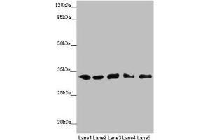 Western blot All lanes: MMACHC antibody at 5. (MMACHC antibody  (AA 63-282))