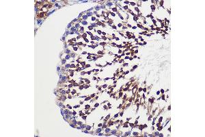 Immunohistochemistry of paraffin-embedded Rat testis using TUBGCP6 Rabbit pAb (ABIN7271055) at dilution of 1:100 (40x lens). (GCP6 antibody  (AA 600-900))