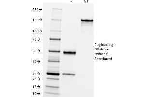 SDS-PAGE Analysis Purified CD10 Mouse Monoclonal Antibody (FR4D11). (MME antibody)