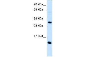 CCL18 antibody (70R-10507) used at 0. (CCL18 antibody  (Middle Region))
