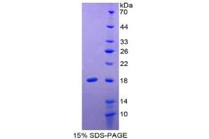 SDS-PAGE (SDS) image for Interleukin 24 (IL24) (AA 51-206) protein (His tag) (ABIN1525481) (IL-24 Protein (AA 51-206) (His tag))
