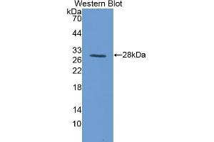 Detection of Recombinant TFR, Pig using Polyclonal Antibody to Transferrin Receptor (TFR) (Transferrin Receptor antibody  (AA 578-765))