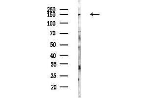 anti-Claspin (CLSPN) (N-Term) antibody