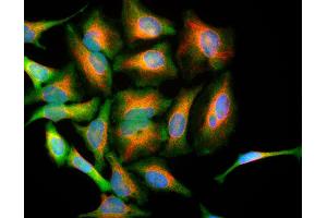 HeLa cells stained with ABIN1842246 (green), and CPCA-Vim chicken antibody to vimentin (red) and DNA (blue). (PARK7/DJ1 antibody)