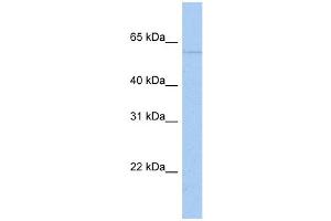 WB Suggested Anti-PAPD4 Antibody Titration:  0. (PAPD4 antibody  (N-Term))