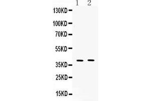 Western blot analysis of MC3 Receptor expression in mouse kidney extract ( Lane 1), and COLO320 whole cell lysates ( Lane 2).