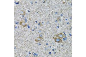 Immunohistochemistry of paraffin-embedded mouse spinal cord using SSBP1 antibody (ABIN5974202) at dilution of 1/100 (40x lens). (SSBP1 antibody)