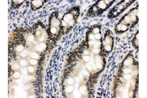 Anti- OGT Picoband antibody,IHC(P) IHC(P): Rat Intestine Tissue (OGT antibody  (C-Term))