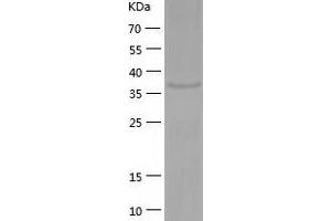 PPME1 Protein (AA 1-386) (His tag)