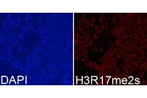 Immunofluorescence analysis of 293T cells using Symmetric DiMethyl-Histone H3-R17 antibody (ABIN3017470, ABIN3017471, ABIN3017472 and ABIN6220102). (Histone 3 antibody  (H3R17me2))
