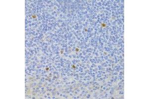 Immunohistochemistry (Paraffin-embedded Sections) (IHC (p)) image for anti-Ficolin (Collagen/fibrinogen Domain Containing) 1 (FCN1) (AA 30-326) antibody (ABIN6140554)
