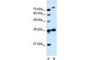 WB Suggested Anti-SLC9A7 Antibody Titration:  0. (NHE7 antibody  (N-Term))