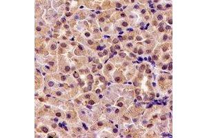 Immunohistochemical analysis of HS1BP3 staining in rat kidney formalin fixed paraffin embedded tissue section. (HS1BP3 antibody)