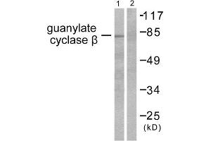 Western Blotting (WB) image for anti-Guanylate Cyclase, beta (GUCYB) (N-Term) antibody (ABIN1848590) (GUCYB antibody  (N-Term))