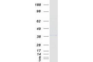 Western Blotting (WB) image for Adiponectin Receptor 1 (ADIPOR1) (Transcript Variant 1) protein (Myc-DYKDDDDK Tag) (ABIN2714419)